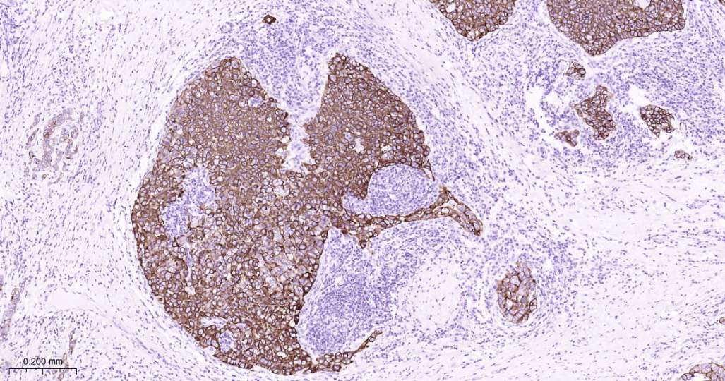 人Keratin 7即用型免疫组化试剂盒-IHC0604H